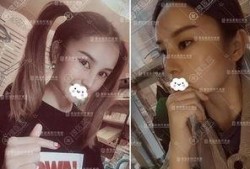 整形手术爆料视频,真实爆料视频曝光全过程